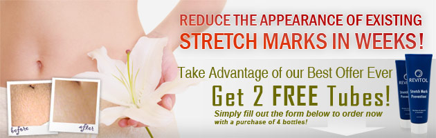 buy revitol stretch mark cream